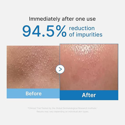 medicube Cleansing Oil Zero Pore Blackhead
