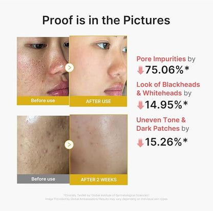 medicube Peel Shot with Kojic Acid Turmeric for Troubled Skin