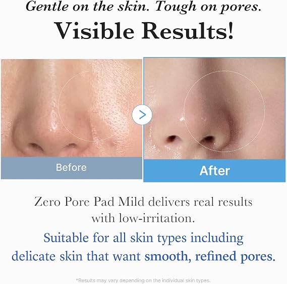 medicube Toner Pads Zero Pore Pad Mild 2.0 for Gentle Exfoliating