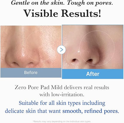 medicube Toner Pads Zero Pore Pad Mild 2.0 for Gentle Exfoliating