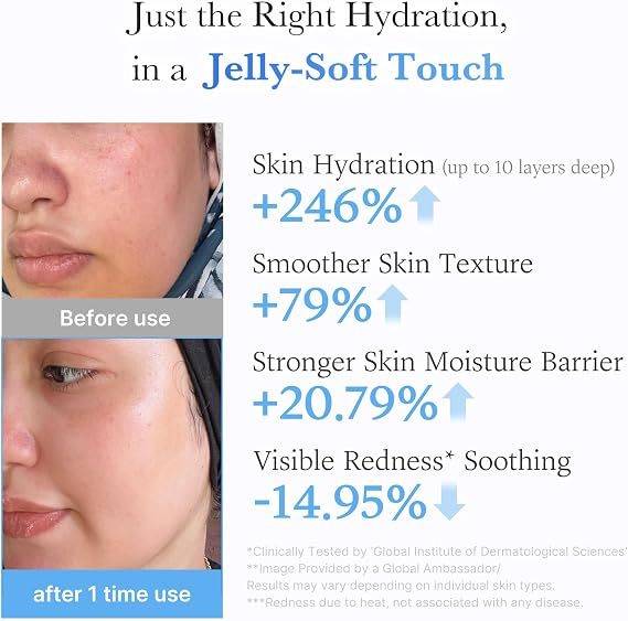 medicube Jelly Cream with Hyaluronic Acid for Long-lasting Hydration