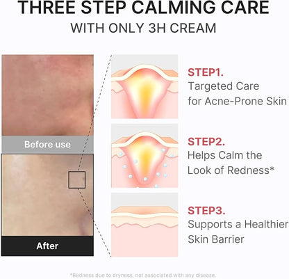 medicube 3H Daily Relief Cream for All Skin Types & After Spot Care